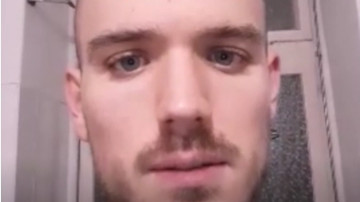 Video von Florian G. nach seiner Haartransplantation Erfahrung in der Türkei