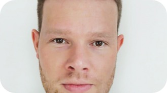 Bericht von Alexander K. nach seiner Haartransplantation Erfahrung in der Türkei