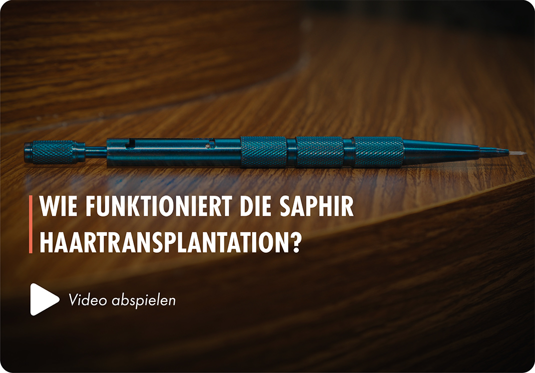 Saphir Haartransplantation Moderne Methode Bei Elithair