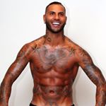 Hair Transplant Experience Quaresma