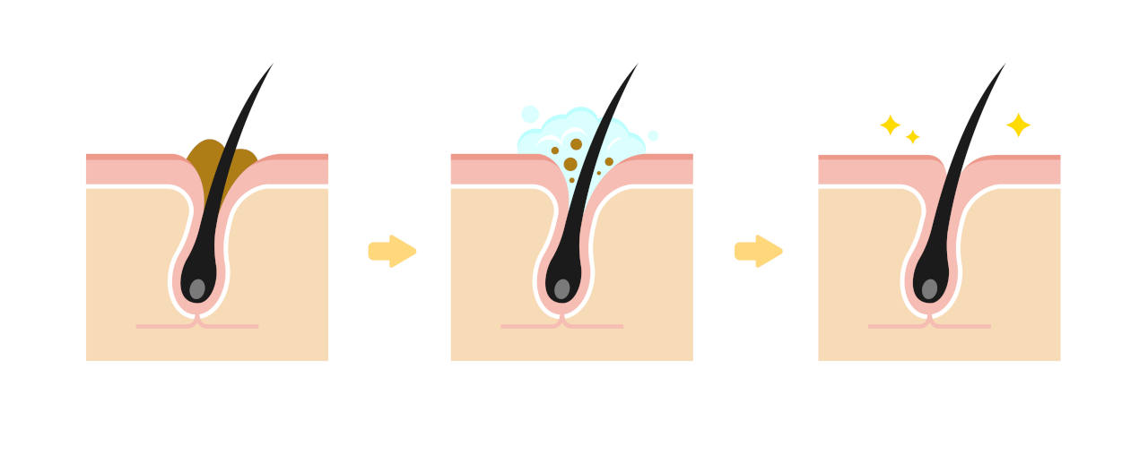 un gommage à l’aloe vera, bon remède contre les pores obstrués