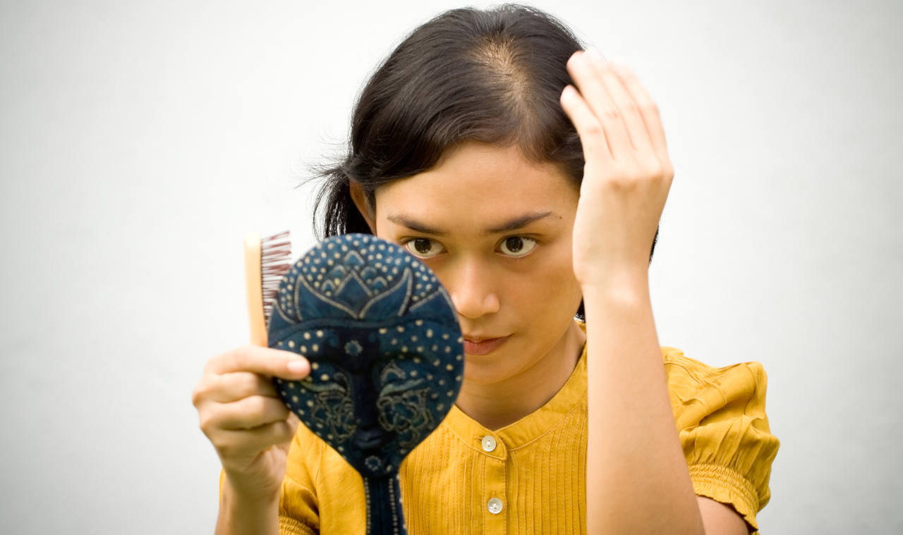 alopécie femme découvrez nos solutions pour enfin retrouver vos cheveux