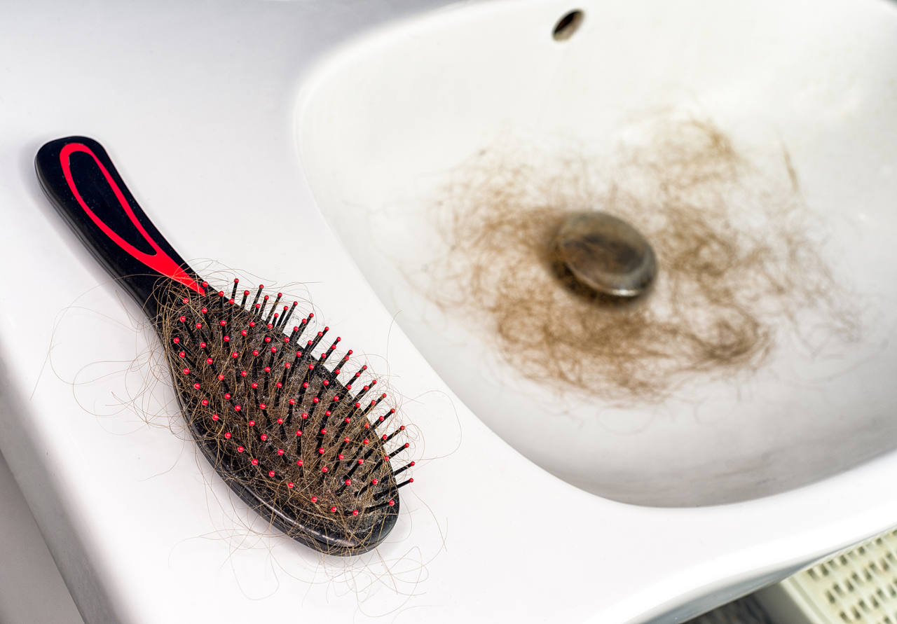 evolution calvitie comment celle-ci se développe