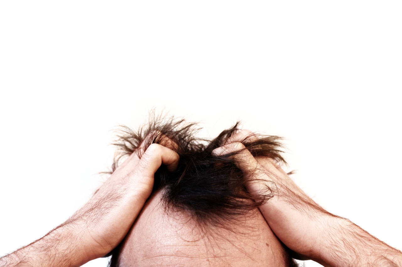 Le haut du crâne d’un homme s’agrippant les cheveux après une greffe de cheveux ratée