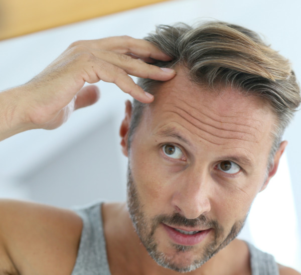 Un homme se regarde dans le miroir et pense à la greffe de cheveux.