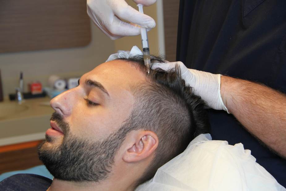 Un patient pendant une injection de plasma riche en plaquettes ou un traitement PRP chez Elithair