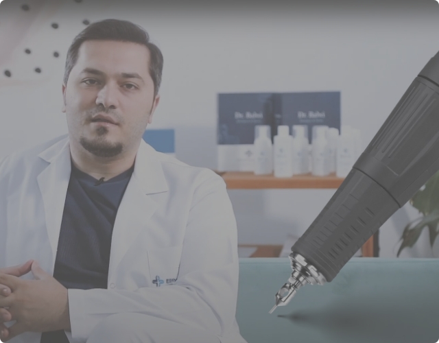 La greffe de cheveux FUE expliquée par le Dr. Balwi