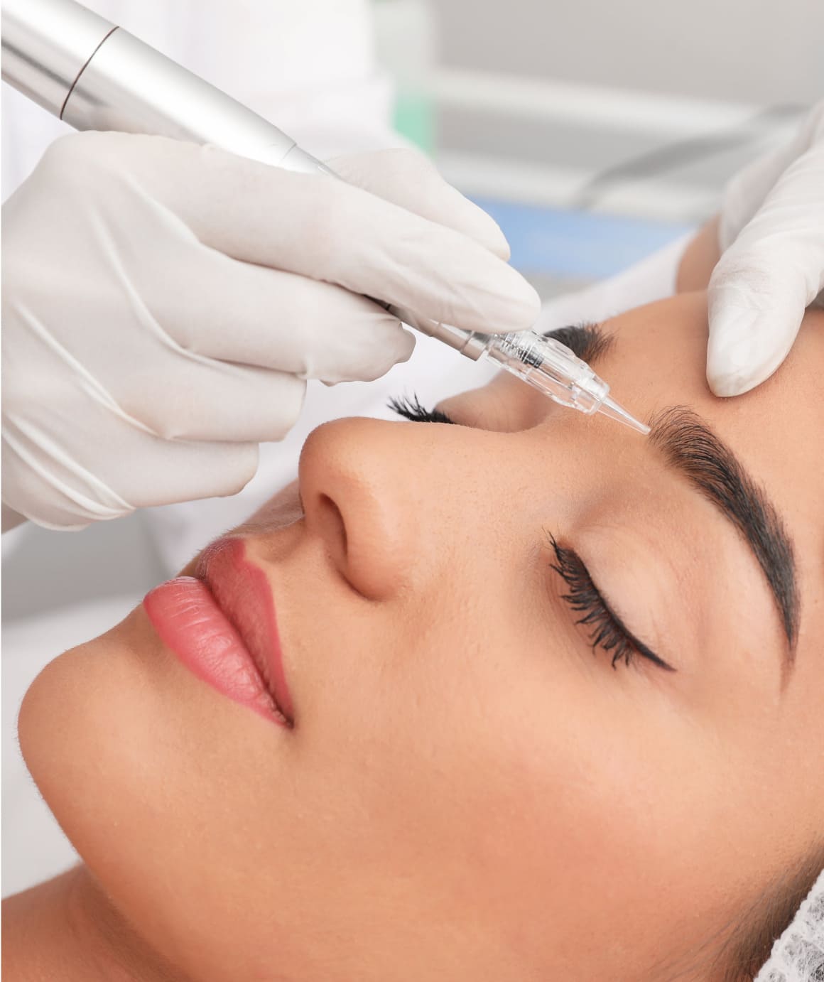 image d'un patient ayant fait sa greffe de sourcils avec elithair