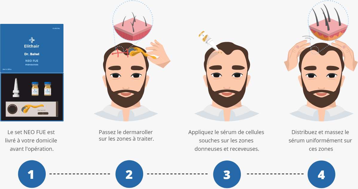 infographique montrant comment utliser la préparation neo fue