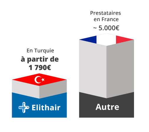 Illustration de la comparaison des prix des greffes de cheveux en Turquie et en France