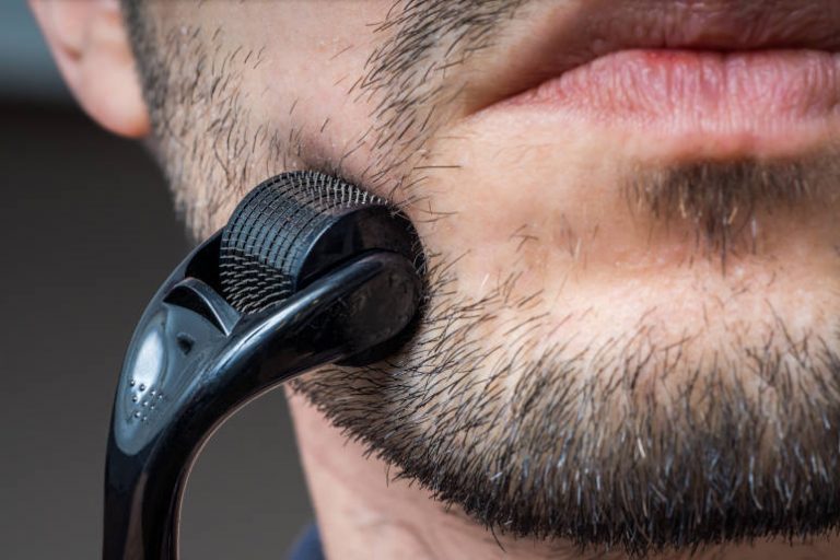 Photo de l'utilisation du microneedling sur barbe éparse