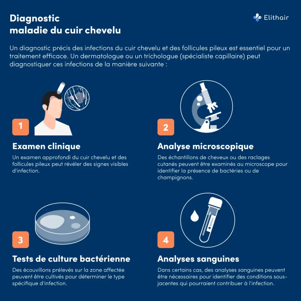 Les étapes du diagnostic d’une maladie du cuir chevelu vu par Elithair