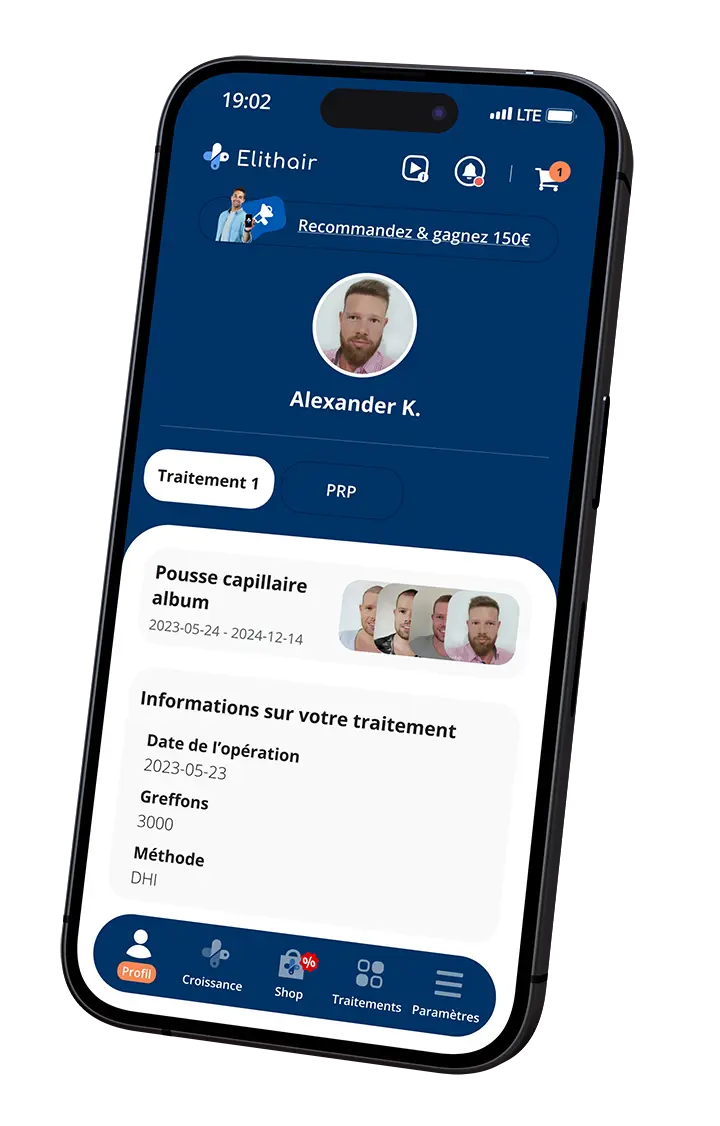 L'écran d'accueil de l'application Elithair pour la greffe capillaire