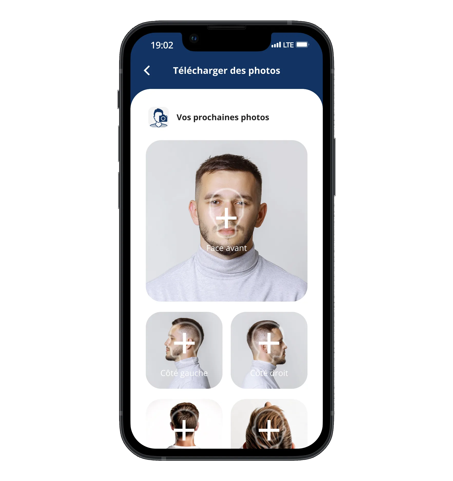 L'écran des photos de l'application Elithair pour la greffe capillaire