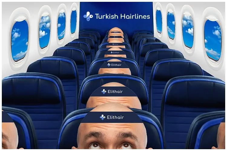 Turkish hairline séduit les nouvelles générations milinenials et z