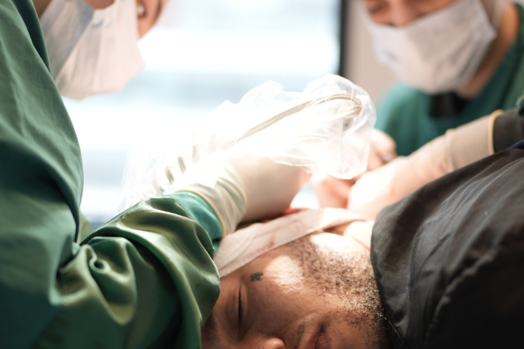 Un patient avec l'équipe Elithair en pleine extraction de ses greffons