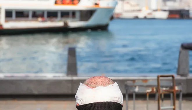 Spaziergang im Hafen von Istanbul mit einem Mann nach einer Haartransplantation