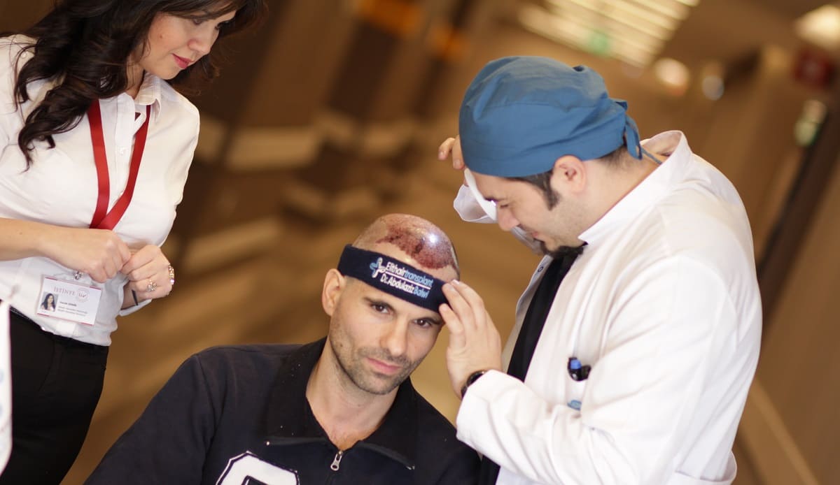 Haartransplantation Voraussetzungen für ein erfolgreiches Ergebnis