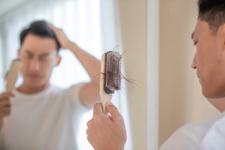 Mann steht vor dem Spiegel und schaut auf eine Bürste, in der Haare hängen