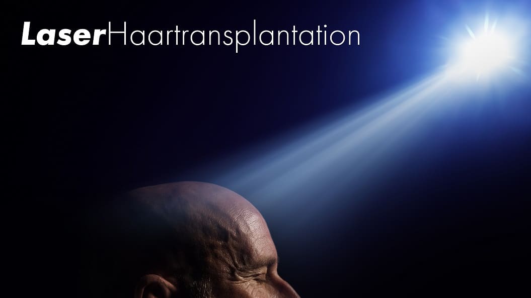 Haartransplantation mit Laser - Gibt optimale Ergebnisse?