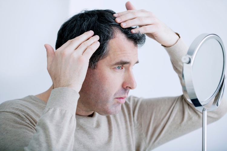 Mann mit Alopecia untersucht seine Haare im Spiegel
