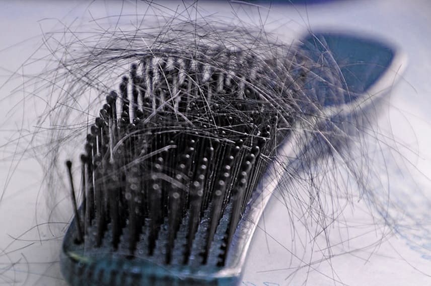 Haarausfall durch bakterielle Infektion - Haare im Kamm