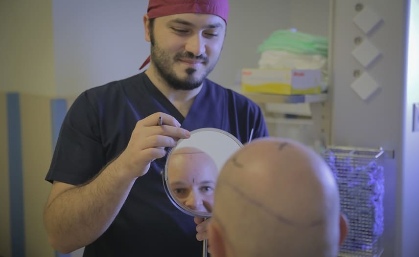 Haare statt Glatze Dr. Balwi zeigt Patienten die natürliche gezeichnete Haarlinie.
