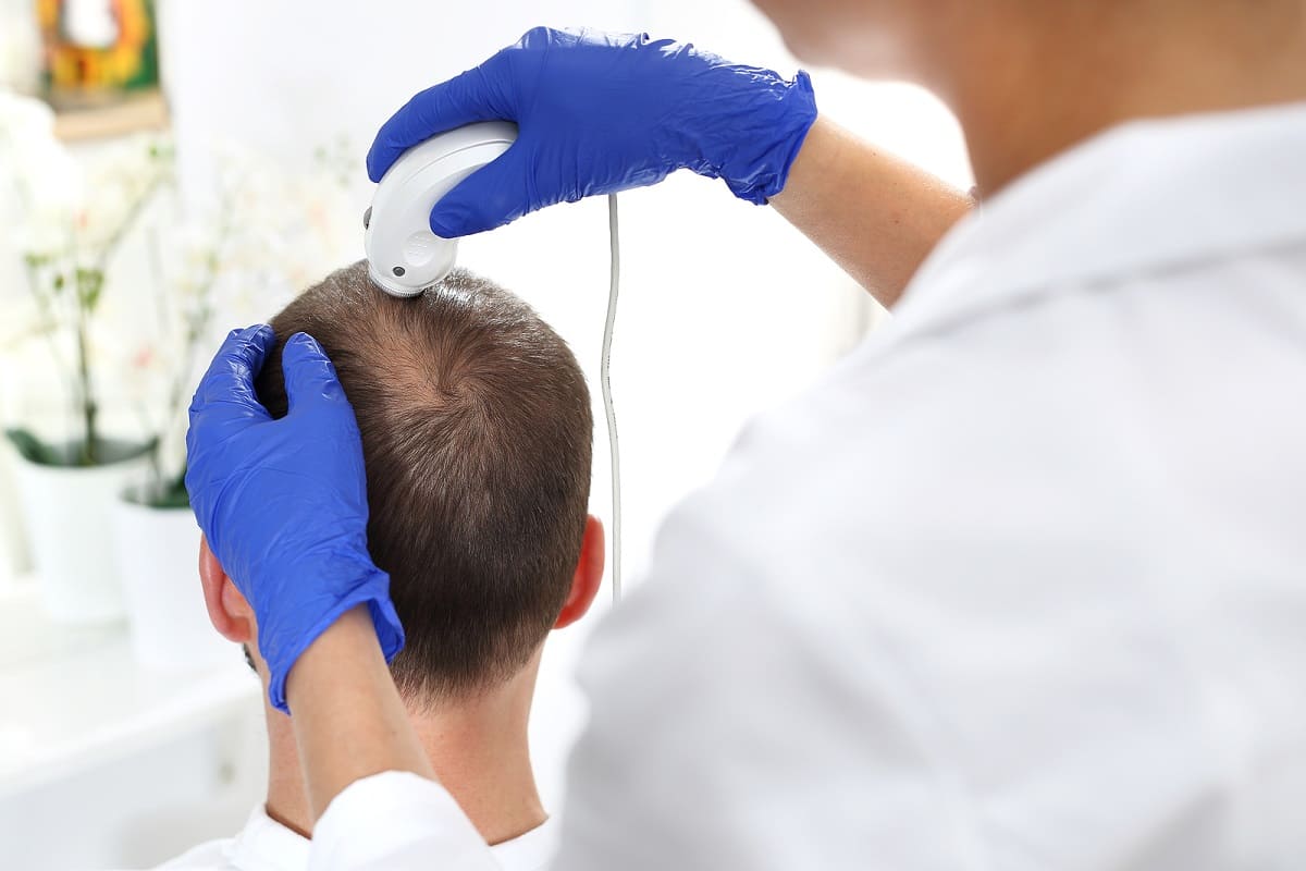 Dermatologe fuehrt eine Haaranalyse mithilfe einer Lupe durch