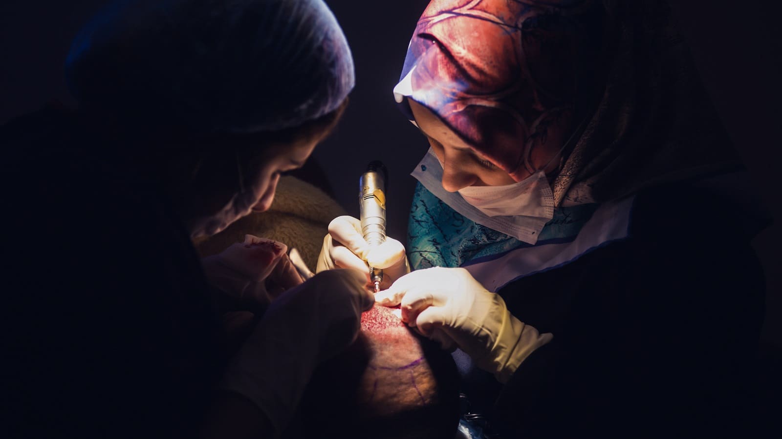 Haartransplantation negative Erfahrung
