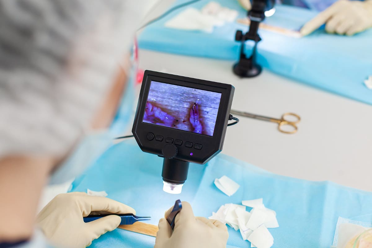 Haartransplantation Instrumente