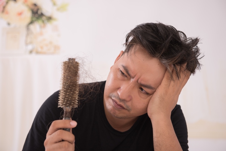 Mann schaut traurig auf eine Bürste in der viele Haare hängen