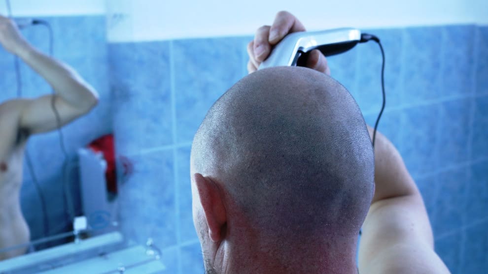 Mann rasiert Kopf statt Haare schneiden vor der Haartransplantation