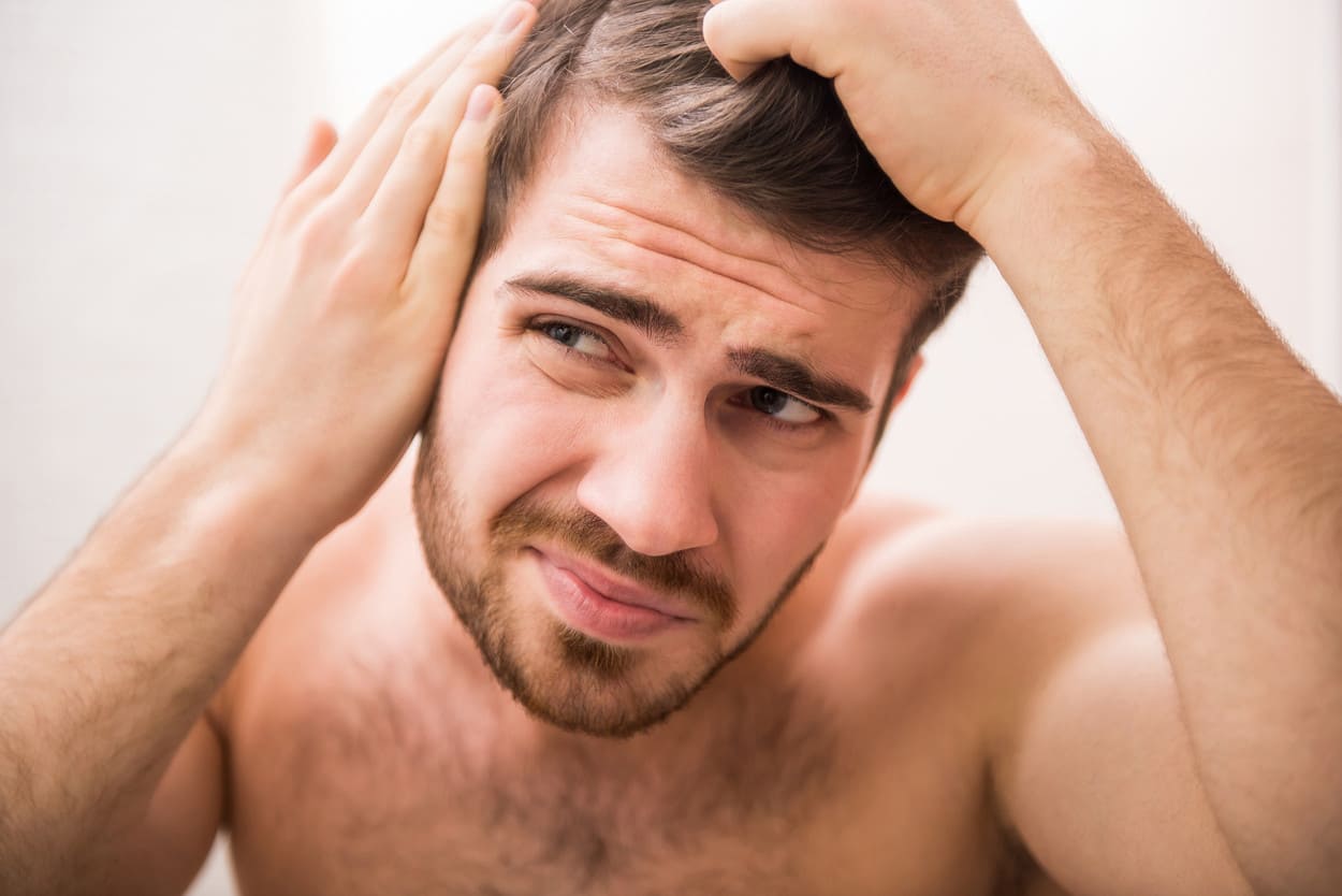 Mann fasst sich in die Haare und plötzlicher Haarausfall besorgt ihn