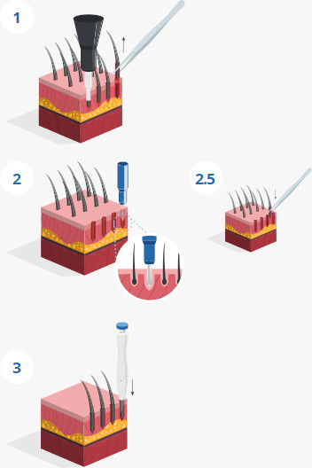 Infografik für SDHI-Technik