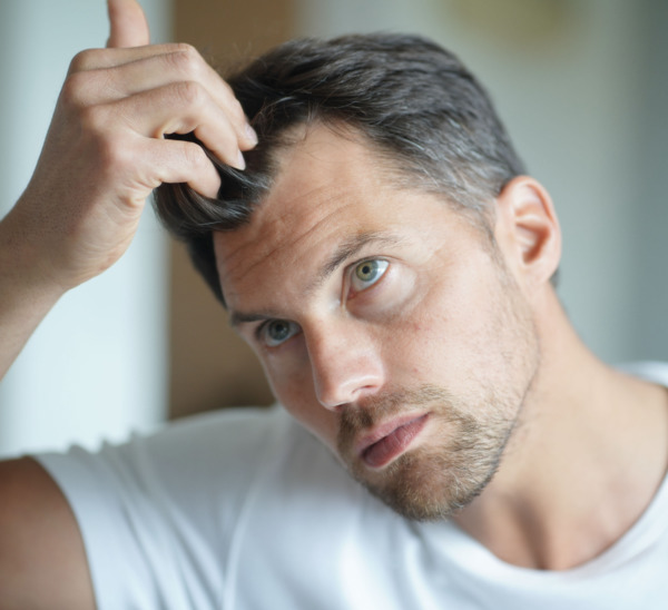 Die Saphir Haartransplantation eignet sich besonders bei dickerer Haarstruktur Nahaufnahme von Ärztin bei der Saphir Haartransplantation