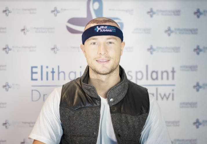 Korrektur einer Haartransplantation