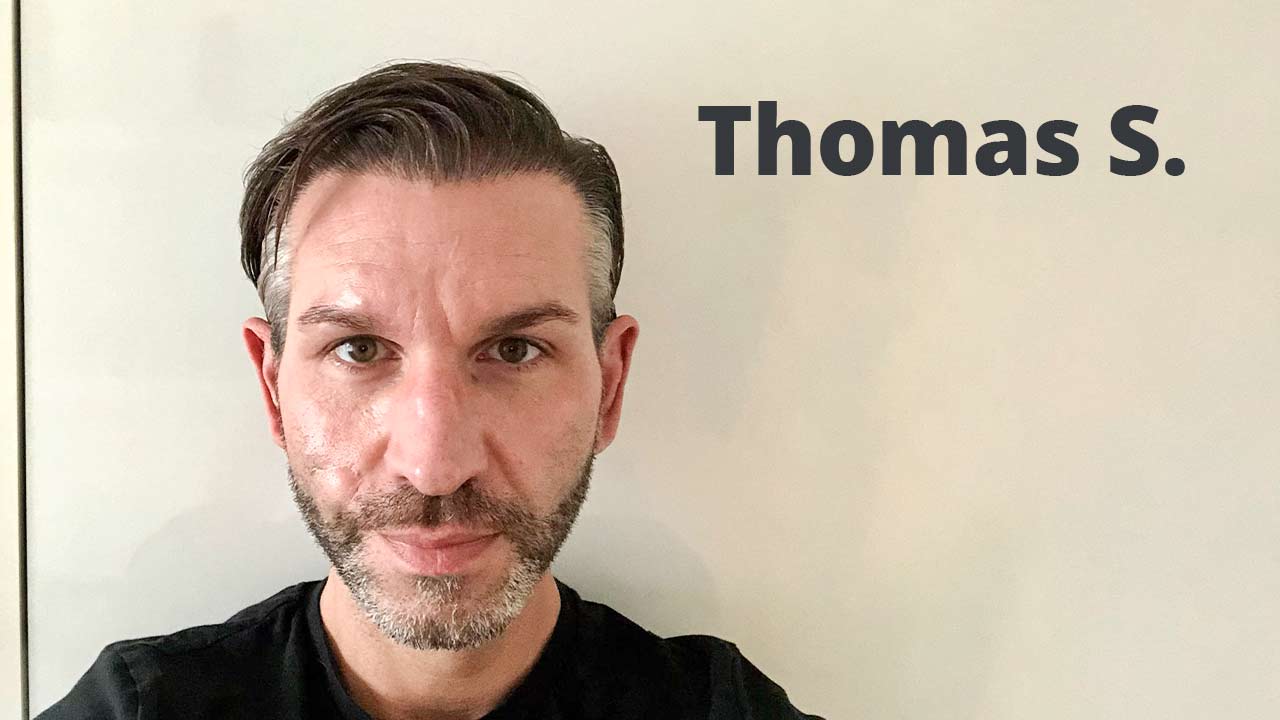 Thumbnail von Patient Thomas Schreier bezüglich der Vorher Nachher Haartransplantation