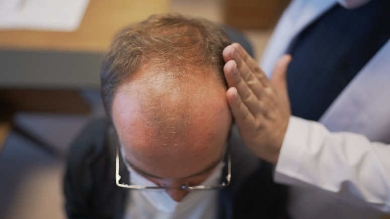 Dr. Balwi analysiert Haarausfall bei männlichem Patienten