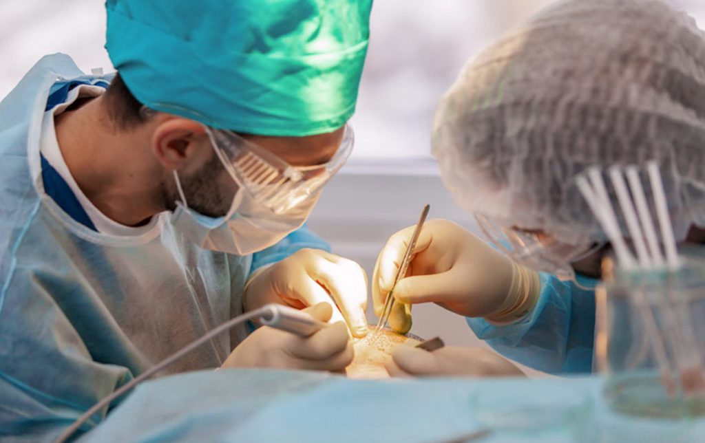 Spezialisten führen FUE Haartransplantation bei einem Patienten durch