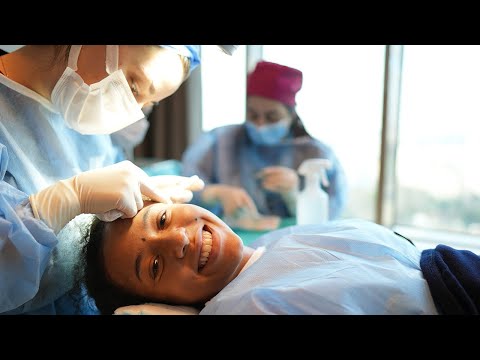 Thumbnail Haartransplantation Frauen bei Patientin Melissa