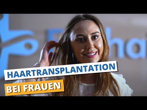 Thumbnail für die Haartransplantation bei Frauen von Patientin Helena