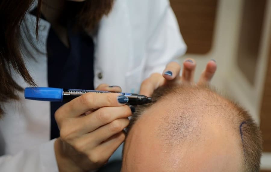Haarärtzin zeichnet auf dem Kopf eines Patienten etwas ein