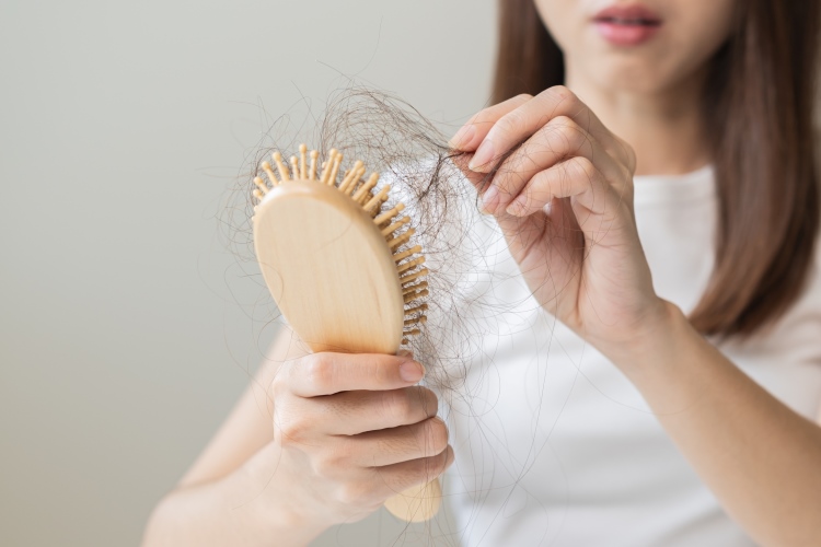 Frau mit Haarausfall zieht Haare aus der Bürste