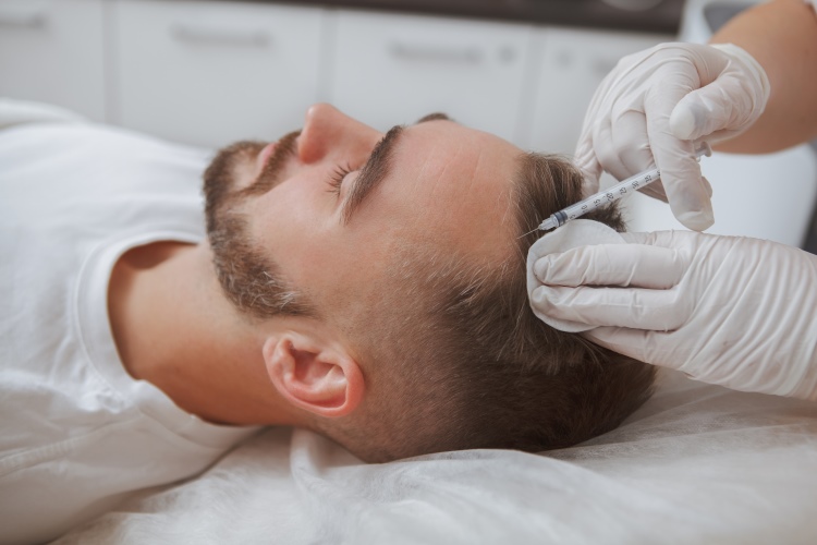 Spezialist injiziert bei Patienten mit einer PRP Spritze in die Kopfhaut eines Patienten