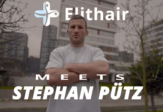 Thumbnail des Videos von Stephan Pütz Haartransplantation bei Elithair