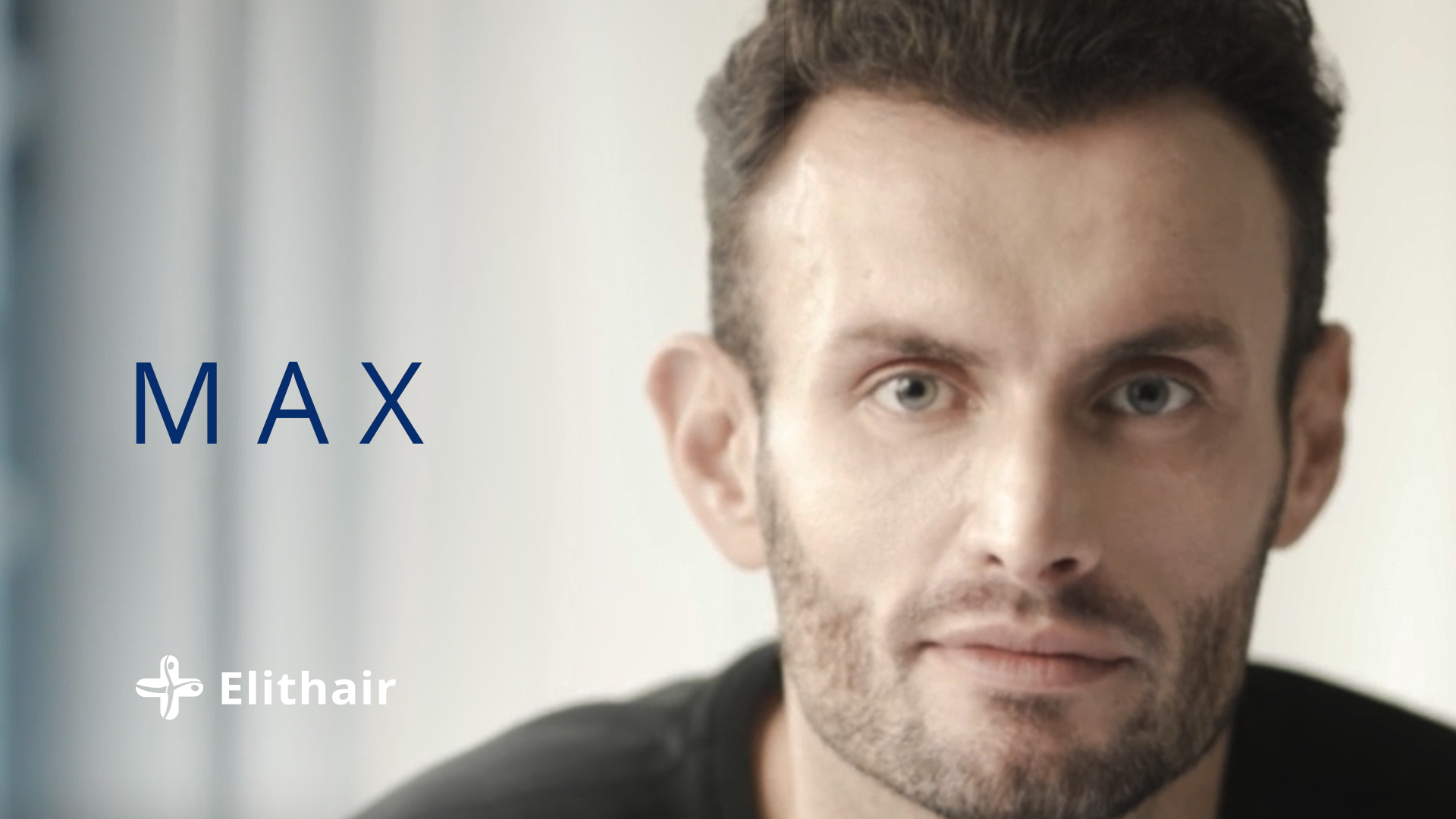 Thumbnail des Testimonal Video von Patient Max für die Haartransplantation in der Türkei