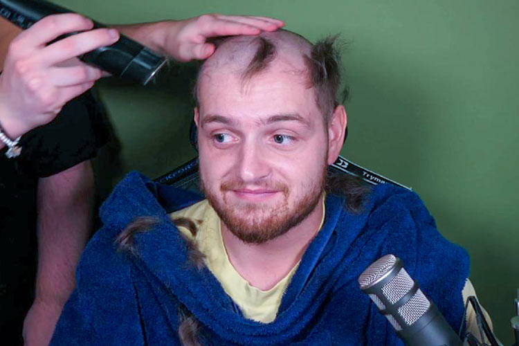 Trymacs rasiert sich eine Glatze in seinem Stream für die Haartransplantation bei Elithair