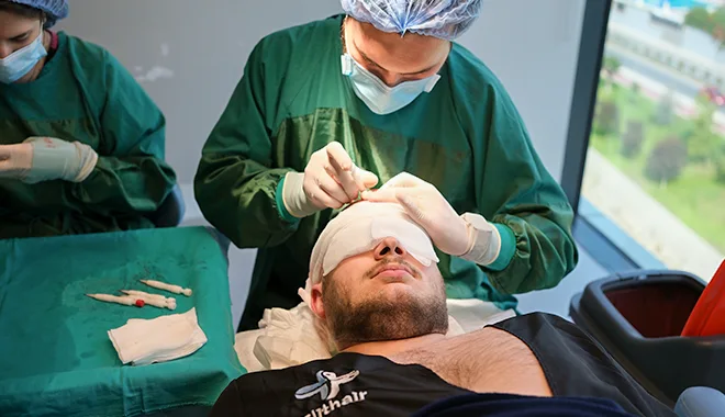 OP Raum mit Patient während einer Haartransplantation bei Elithair
