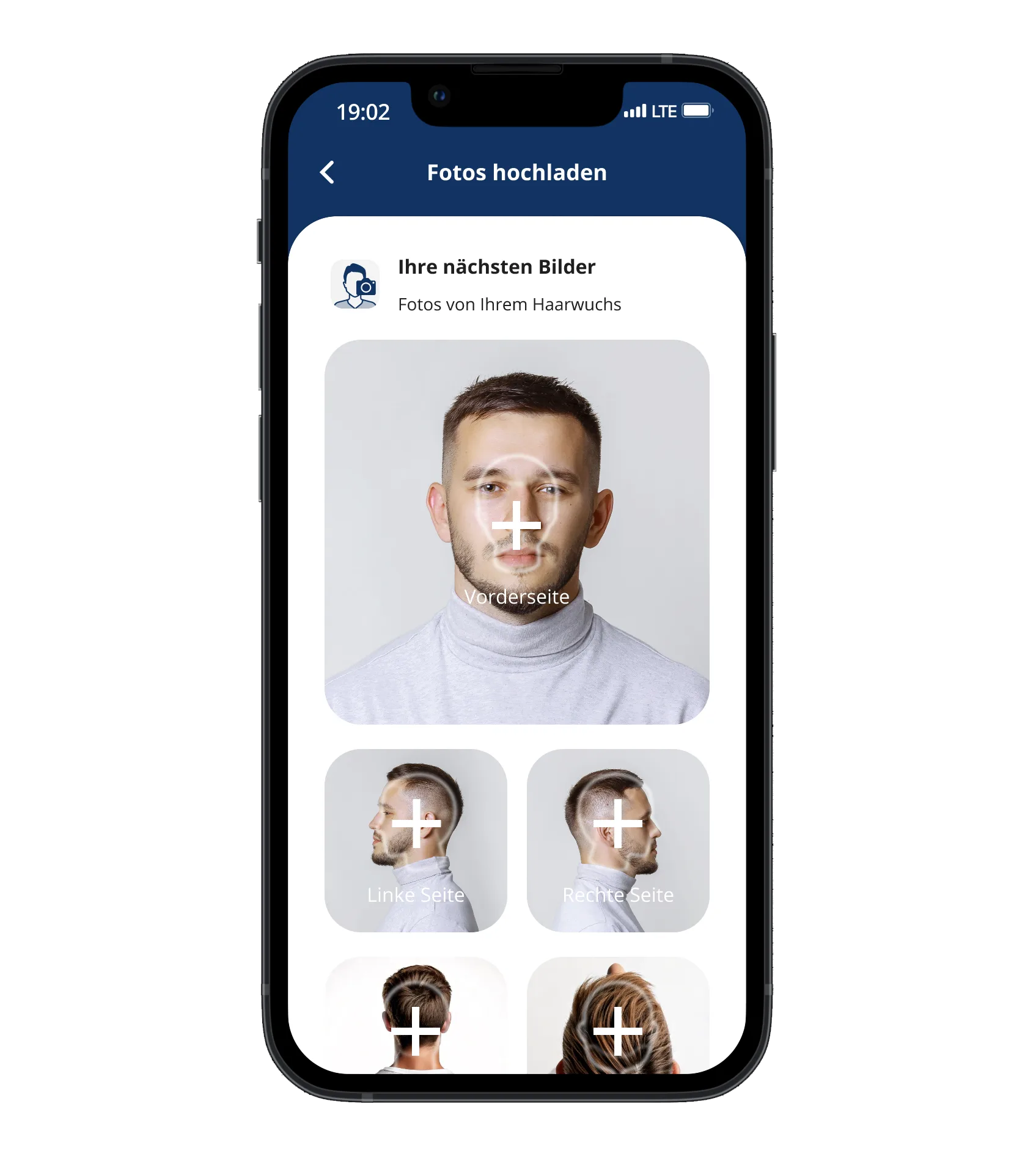 Der Fotos Bildschirm der Elithair-App für Haartransplantation