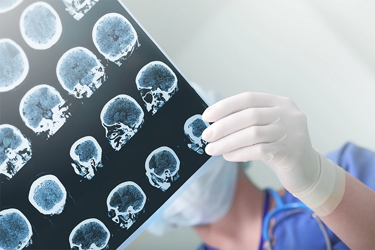 Ein Arzt mit Handschuhen wertet ein EEG-Bild aus – symbolisch für neurologische Forschung und mentale Prozesse